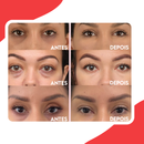 EyeRenew™ Removedor Poderoso de Olheiras