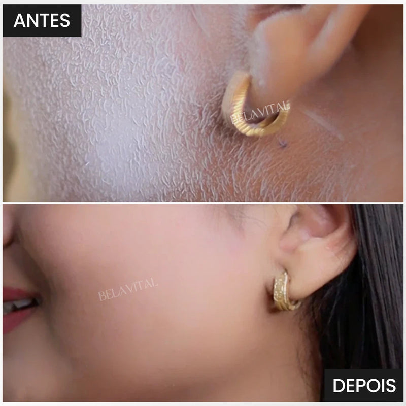 Visispray - Identificador de Pelos Invisíveis [Brinde 4 aparadores]